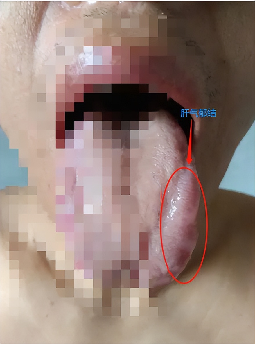 小孩经常生气的坏处,发火生气对身体的坏处