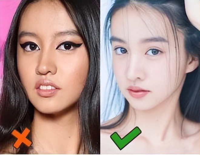 嘴凸有法令纹改善对比,嘴凸法令纹会变严重吗