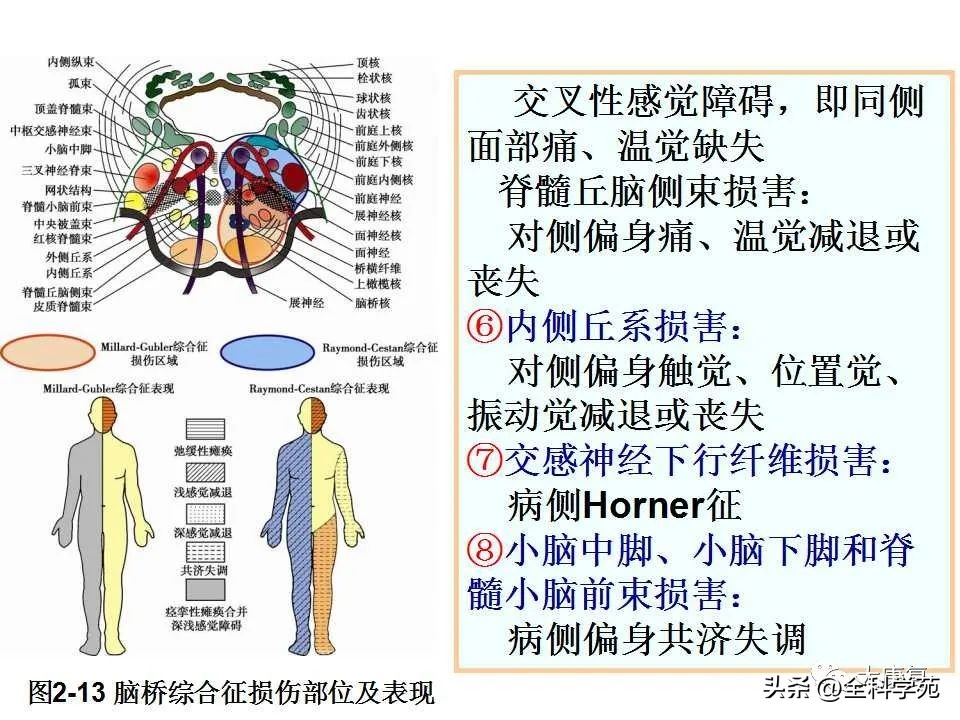 神经系统的影像与解剖定位,最全神经解剖图