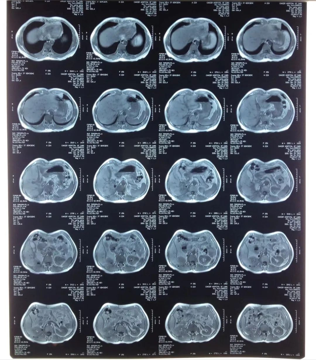 自己赴美就医难吗,赴美就医后续