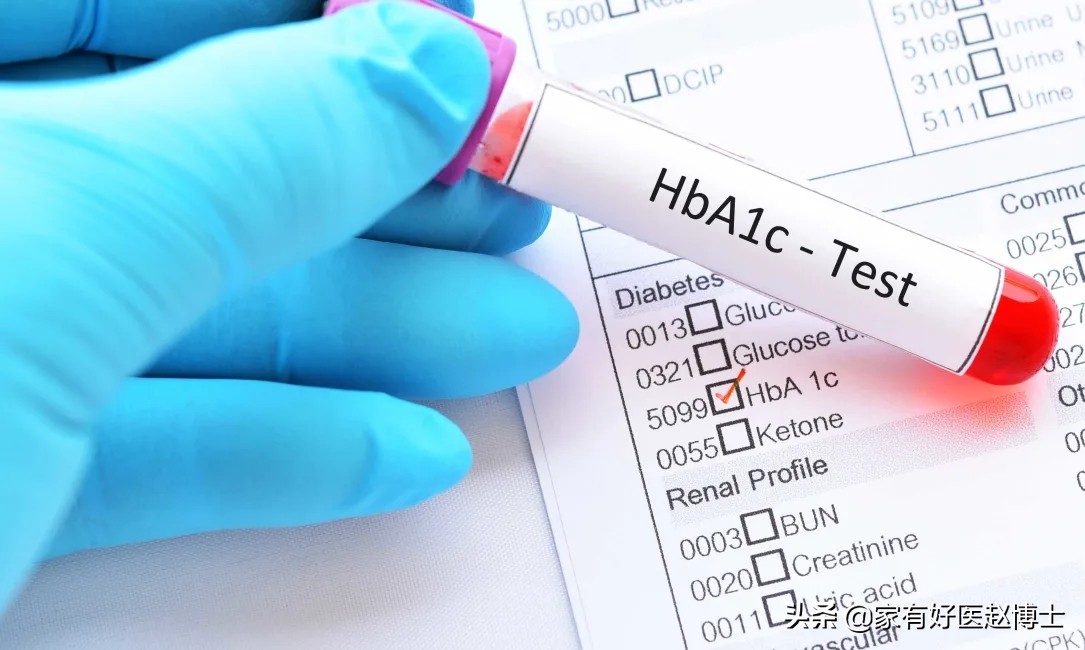 血糖空腹要几个小时才能测血糖,空腹血糖需要多长时间可以测血糖