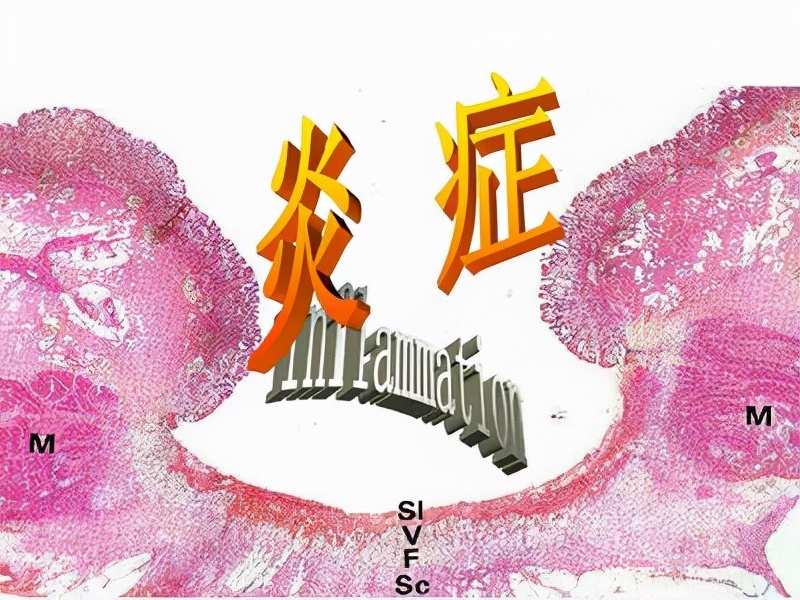 从炎症到癌症需要多久,从炎症到癌症要多久时间