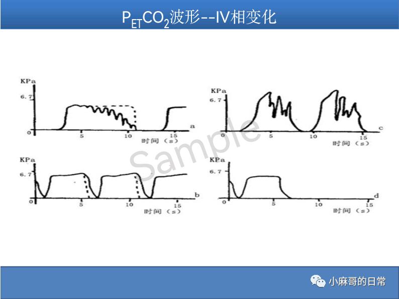 呼气末二氧化碳检测图的解读,呼气末二氧化碳检测操作视频