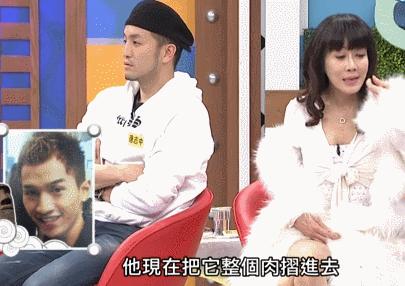 台湾艺人整形记：削骨换脸小场面，嫁给医师保修终身