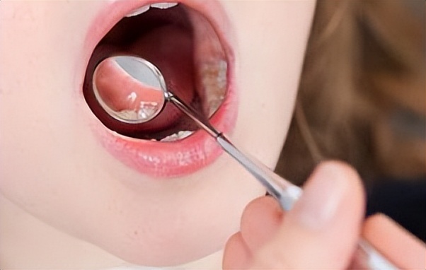 牙周炎跟血液有关系吗,牙周疾病与心脑血管疾病的关系