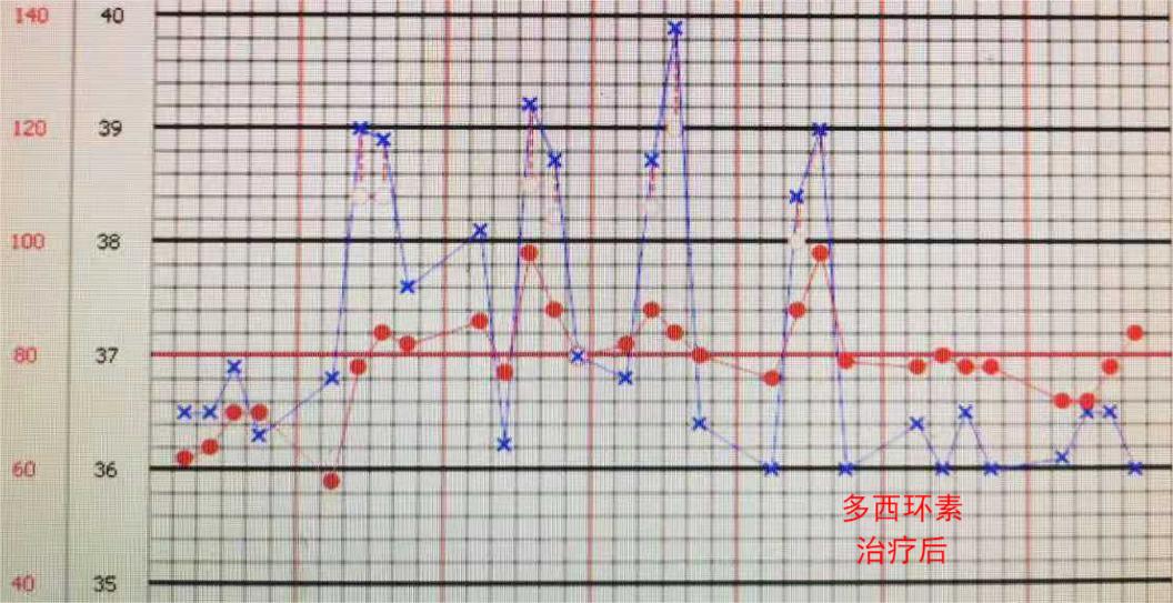反复发烧但是拍片显示轻微肺炎,一直高烧39-40是肺炎么