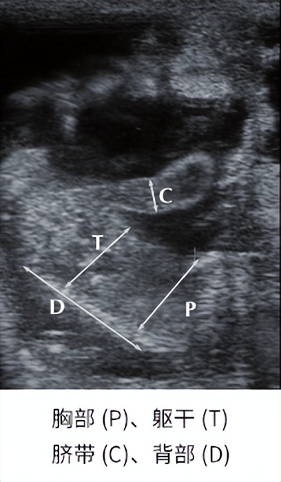b超检测羊孕方法,怀孕羊b超图像