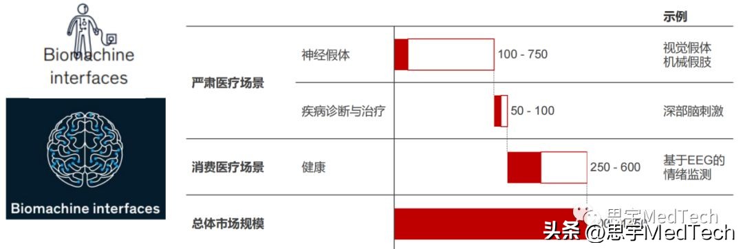 一文读懂马斯克展示脑机接口,一文读懂脑机接口
