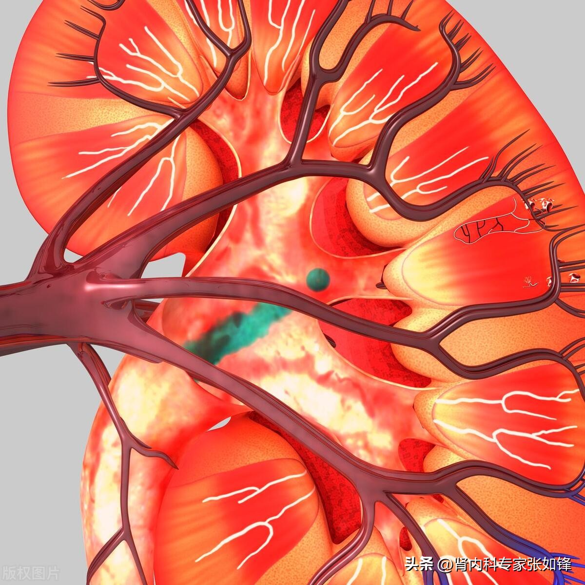 肾病尿毒症能活多久取决于什么,你的肾好不好