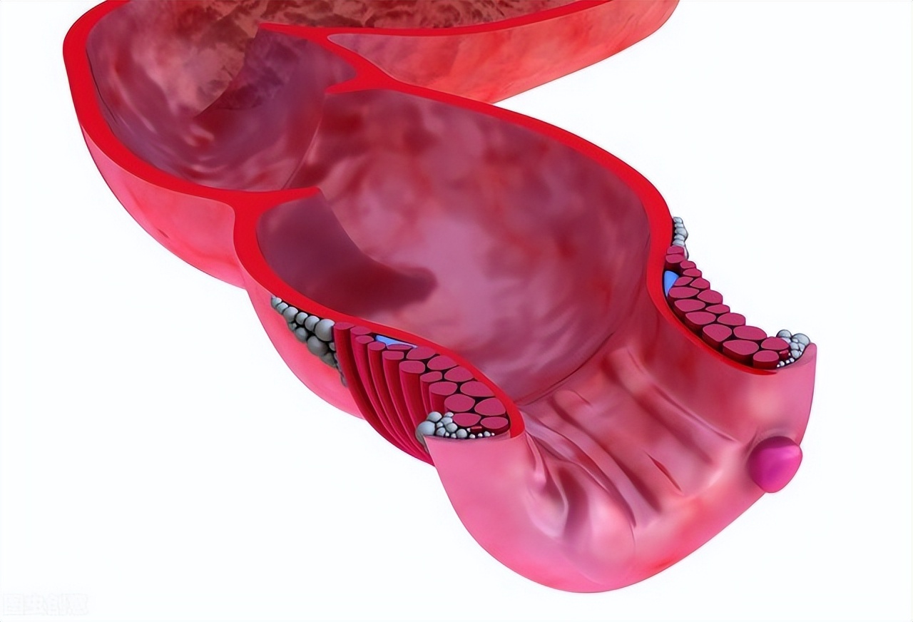痔疮手术第一次换药前能拉屎吗,痔疮手术后拉大便的诀窍