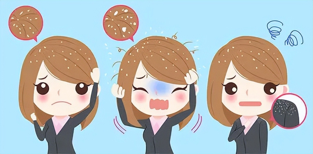 头皮屑与菌群有关，科学的去屑建议