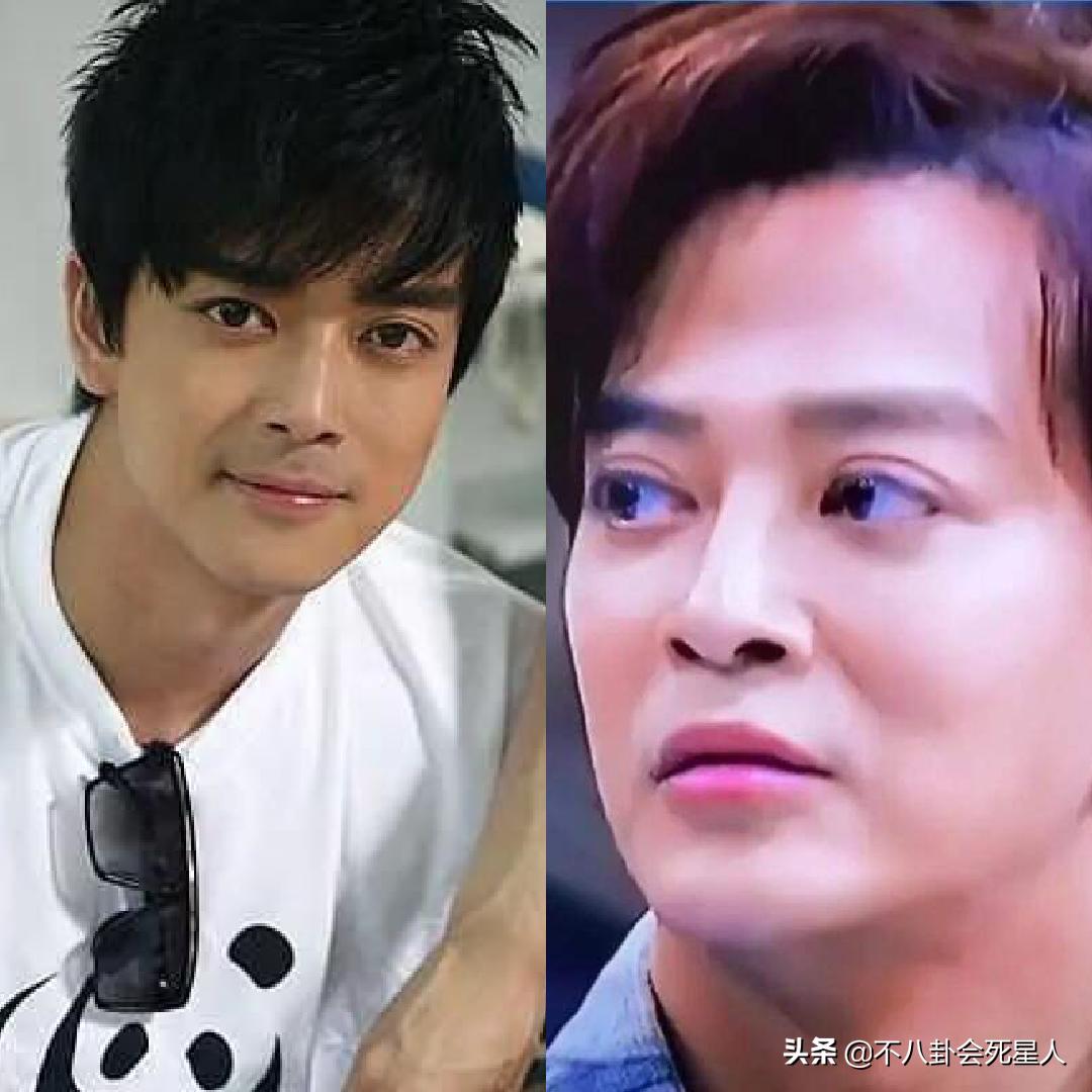 景甜悲伤蛙双眼皮照片,明星割双眼皮前后对比图