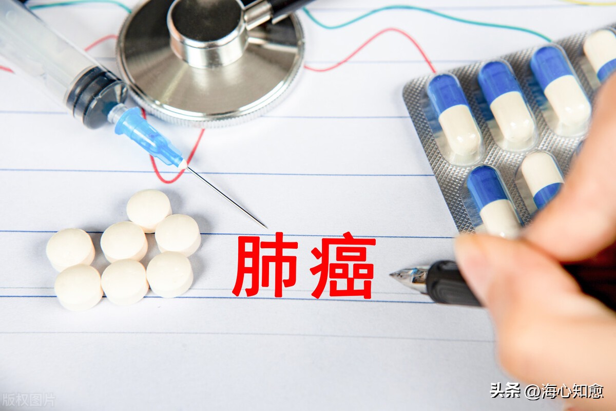 小细胞肺癌ep方案效果,小细胞肺癌EP化疗方案