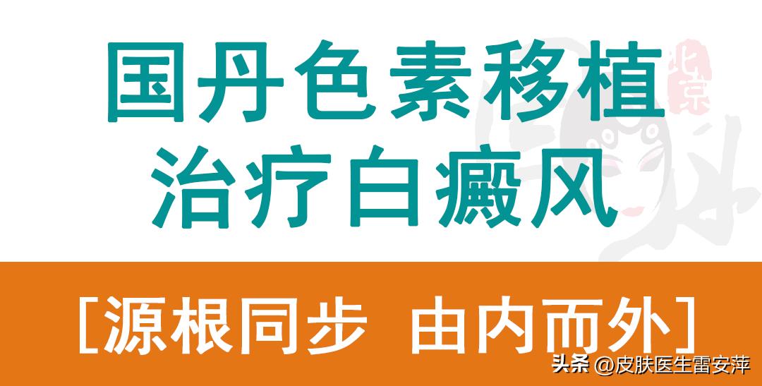 皮肤白癜风怎么遮盖,白癜风手上的白斑是不是最难治疗