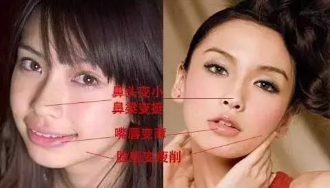 因整容毁掉前途的女星,整容改命的五位明星