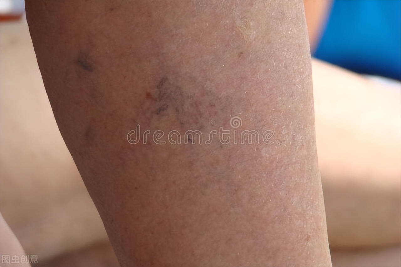 金匮肾气丸和什么吃效果最好,金匮肾气丸5种搭配