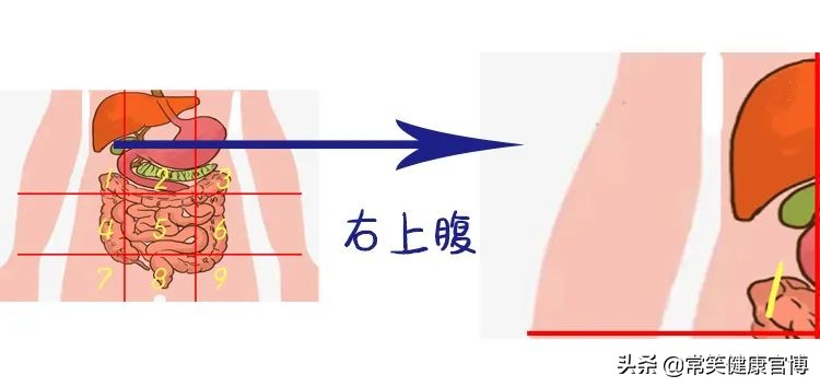 肚子疼胀痛部位对照表,肚子疼是哪里有问题一张图告诉你