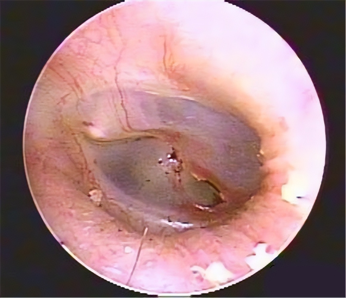 小石头学习视频,小石头学武术疼哭