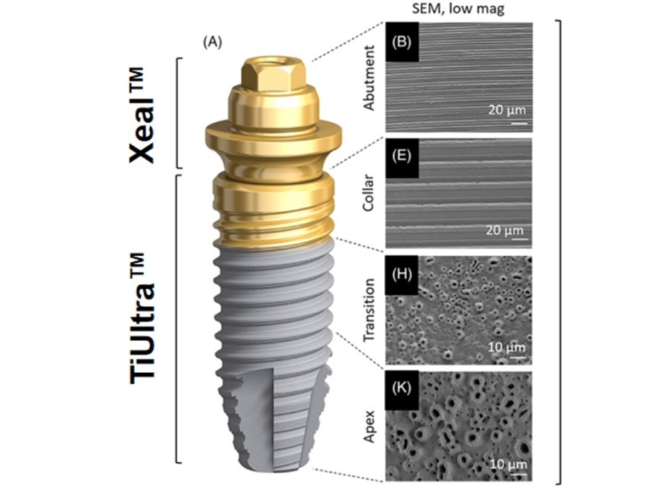 瑞士诺贝尔高端种植牙,诺贝尔金致植体奥齿泰