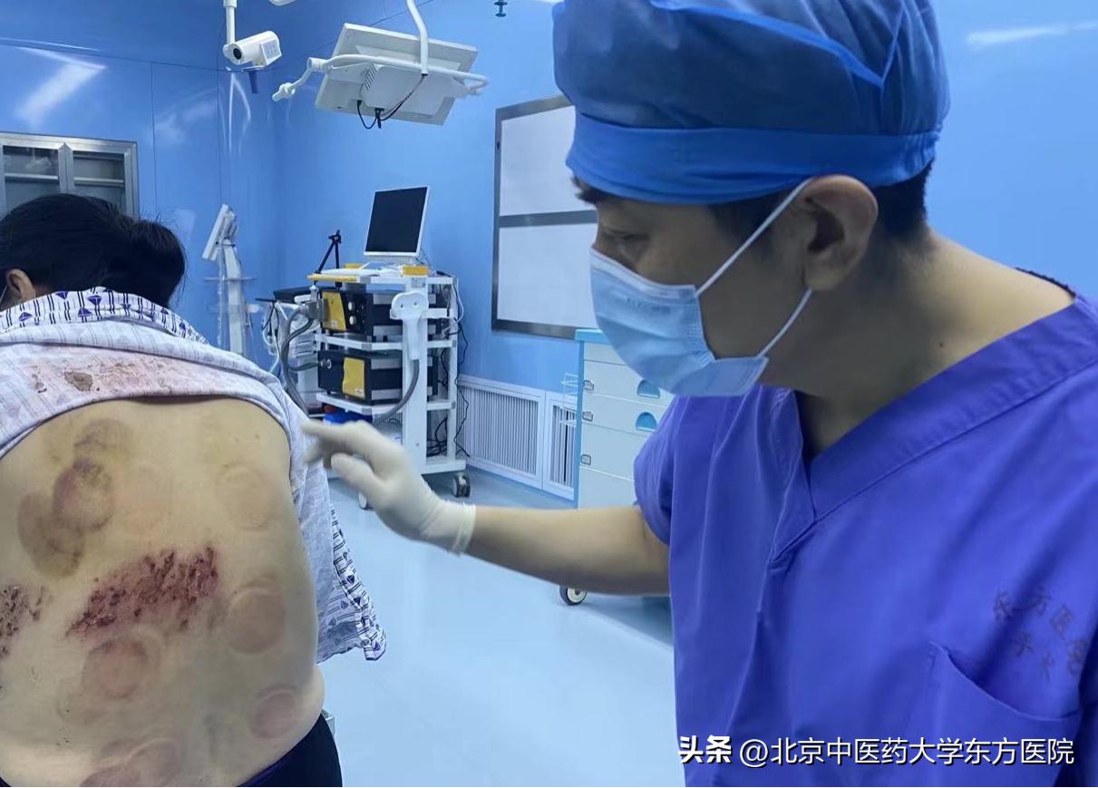 带状疱疹的疼痛和出疹有关联吗,带状疱疹神经痛会越来越痛吗