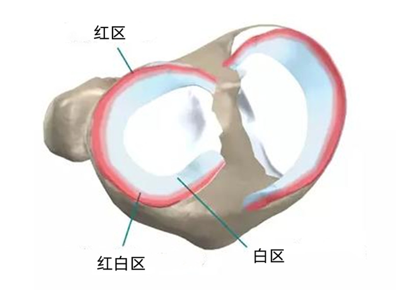 半月板部分切除对膝盖的影响,膝盖没有半月板