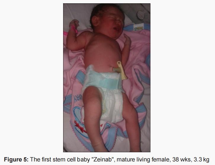 干细胞对卵巢功能衰退的治疗,干细胞应用于卵巢早衰的原理