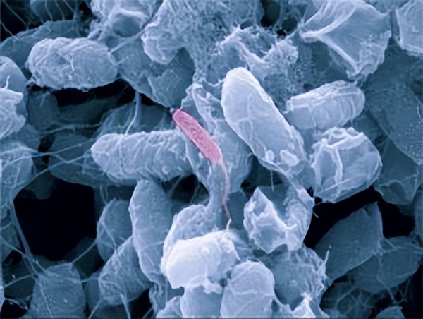 季节性食物中毒安全常识,大规模食物中毒的主要致命菌