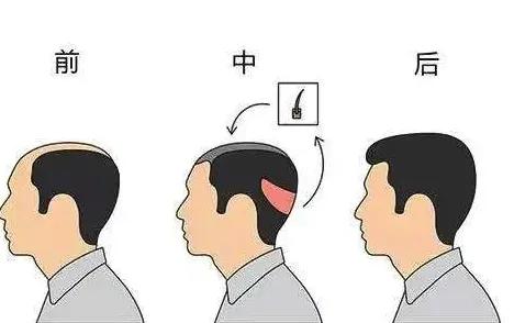 清热化痰治失眠药,清热化痰宁心安神中成药