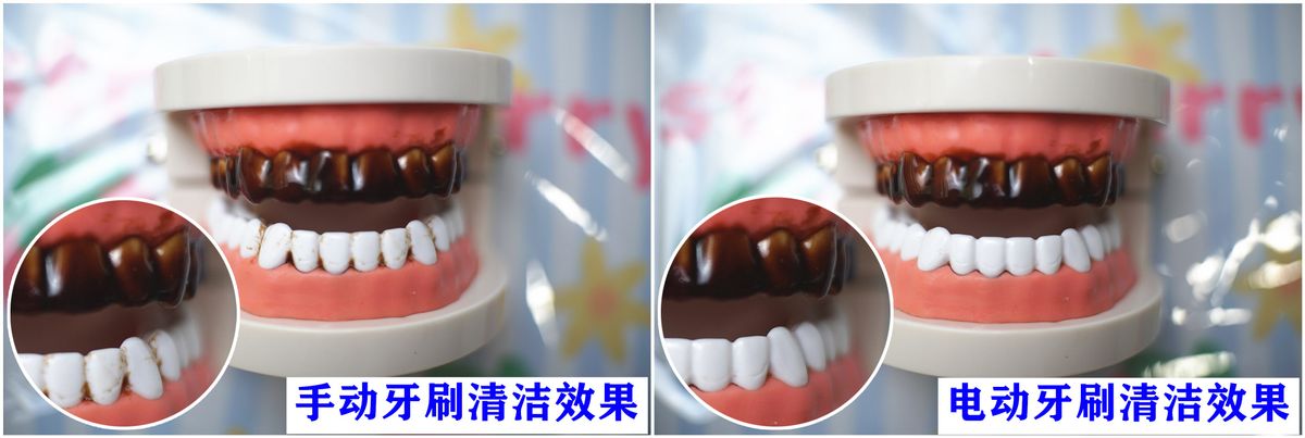 儿童电动牙刷的好处和危害,小孩电动牙刷危害