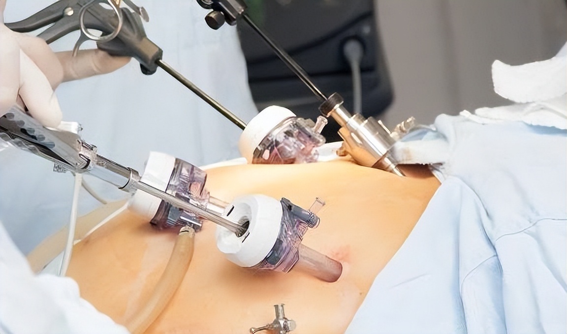 眼睛里容不下一粒沙子的人,眼睛容不得沙子的女人