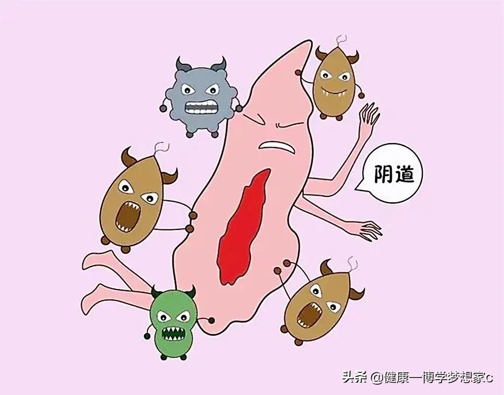 外阴瘙痒分几种情况,外阴瘙痒怎么判断是什么原因