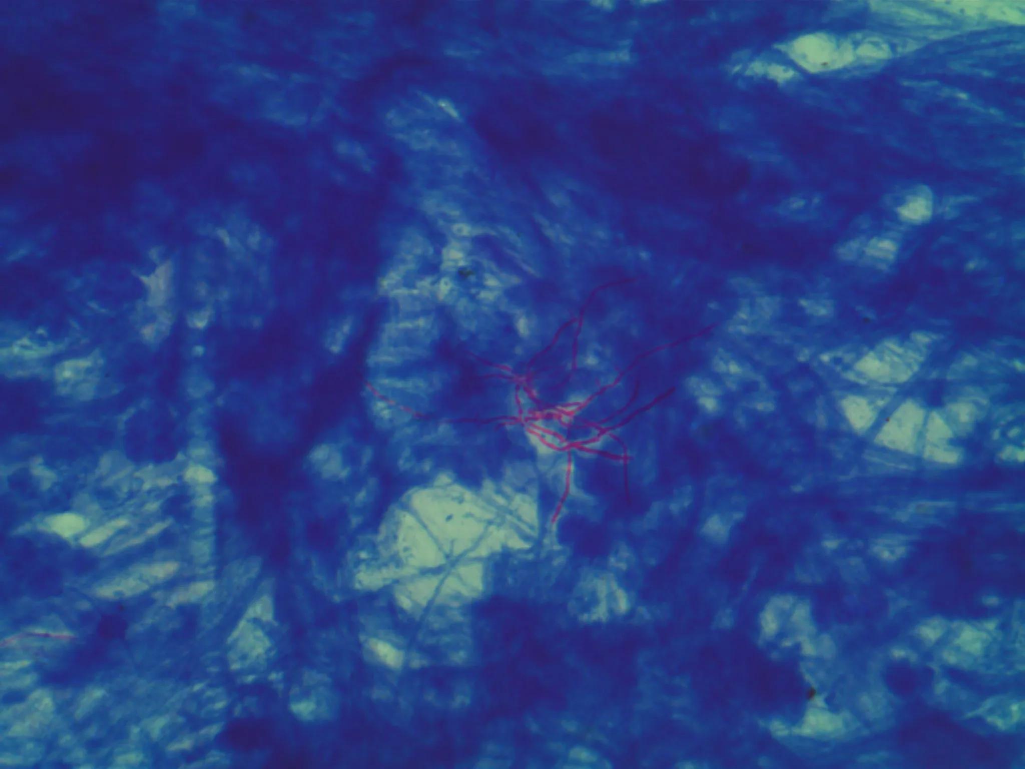 奴卡菌和结核菌,奴卡菌属于非结核分枝杆菌吗