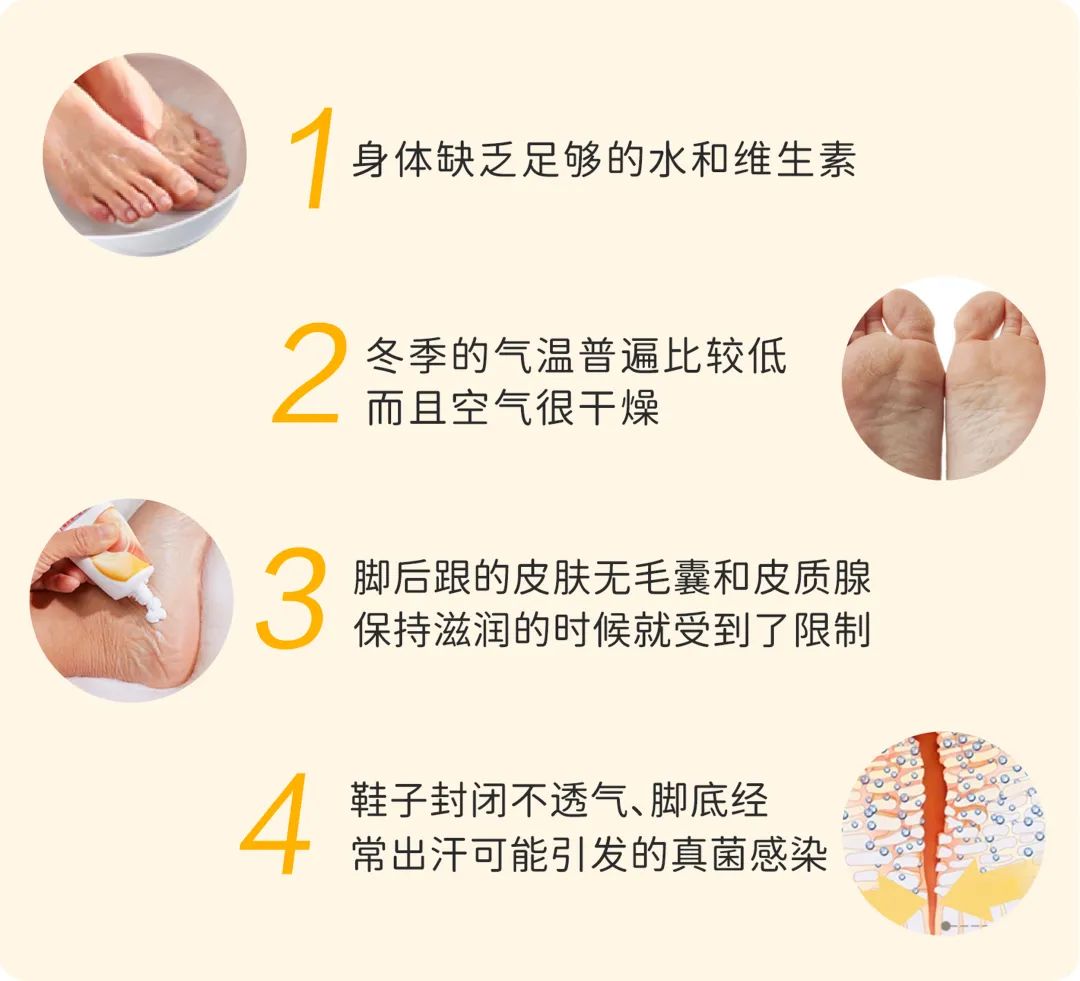 足力健改善案例,足力健保养方法