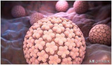 50岁女性患外阴癌,后悔不已!警示女性:出现下身不舒服,别忽略