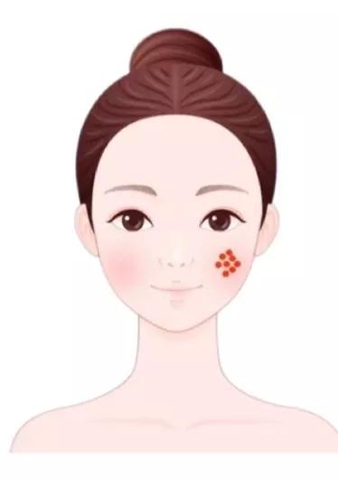 治疗痘痘和痘印最有效的产品内调,腮边反复长大硬包痘痘怎么内调