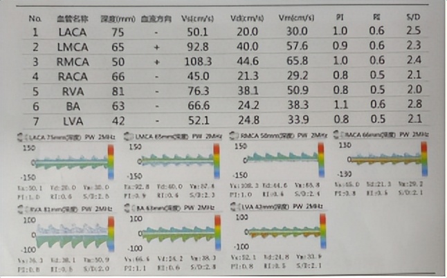 颤抖的双手,三种症状提示可能患有帕金森疾病