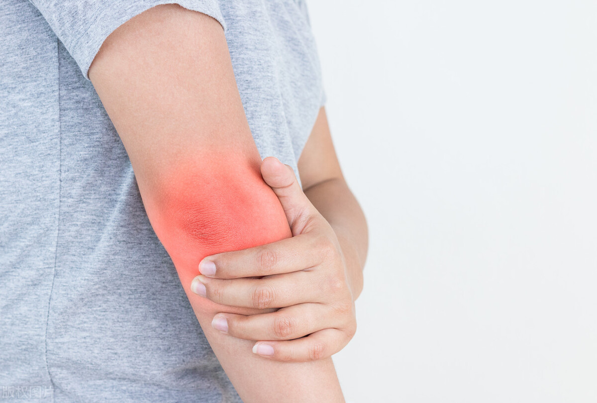 牛风湿病的表现,产后风湿病的表现