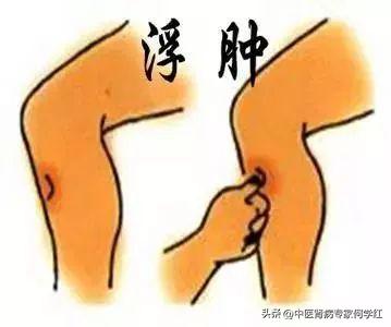 补肾降尿蛋白的中药有哪些,降尿蛋白中药方剂