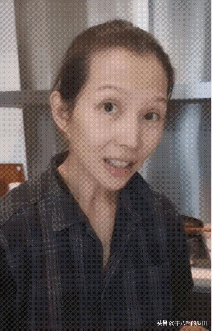 瘦到脱相的几位明星,12位瘦脱相的明星憔悴苍老