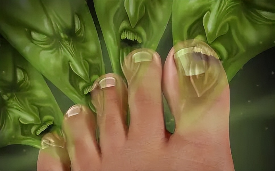 足癣真菌感染怎么治疗,治疗足癣的药膏哪个好