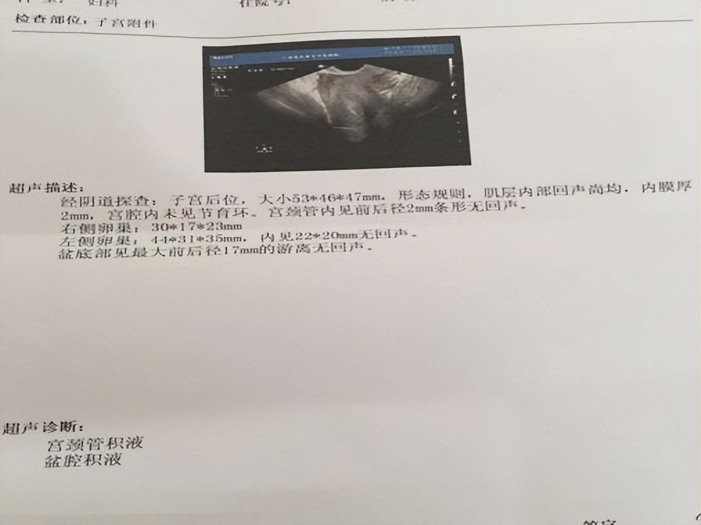 盆腔炎杀手,女性妇科疾病隐形杀手