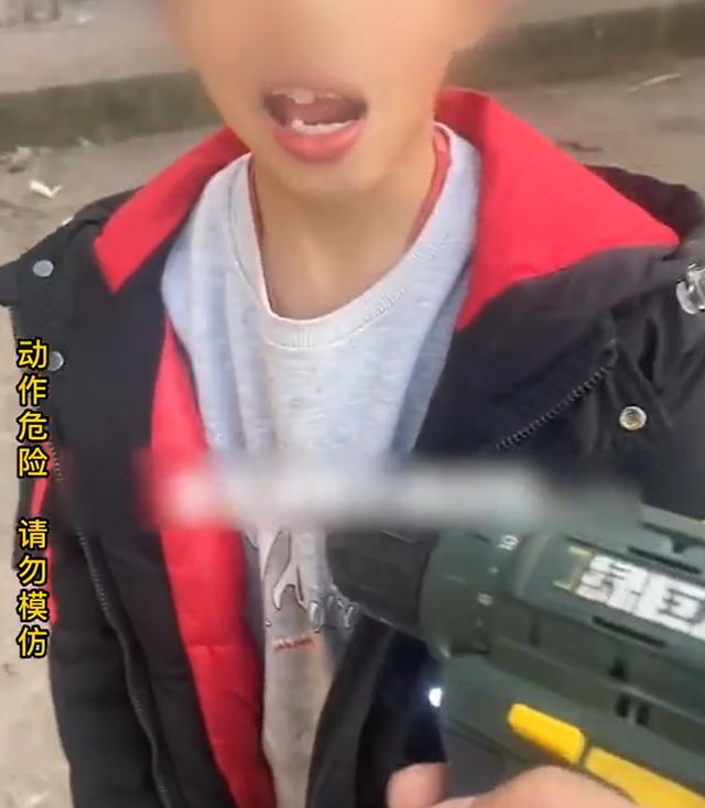 男孩蛀牙牙疼怎么办立刻止疼,男孩子蛀牙