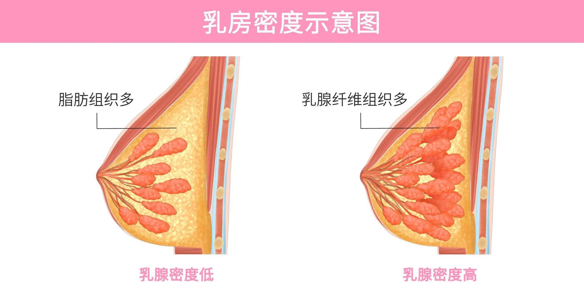 胸部是不是要经常轻按摩,胸部是不是不能随便用力按摩