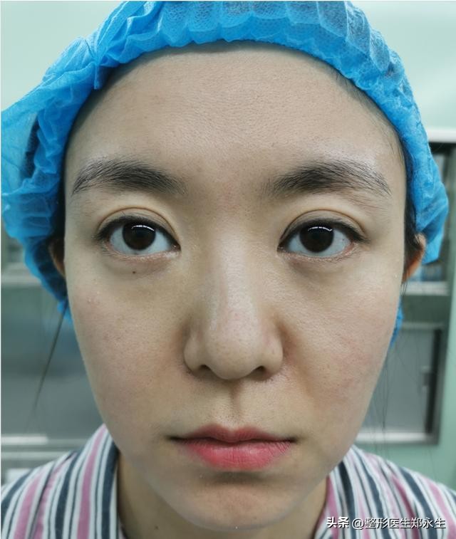 下眼睑磨得慌发涩怎么回事啊,下眼睑干的起皱起皮怎么回事