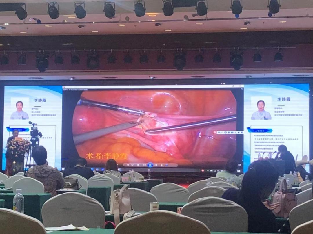 河北工程大学附属医院妇科李静霞,河北省中医院李静医生