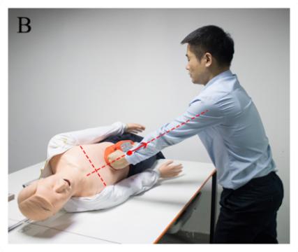 腹部提压心肺复苏术有用吗,腹部提压心肺复苏和胸外心脏按压