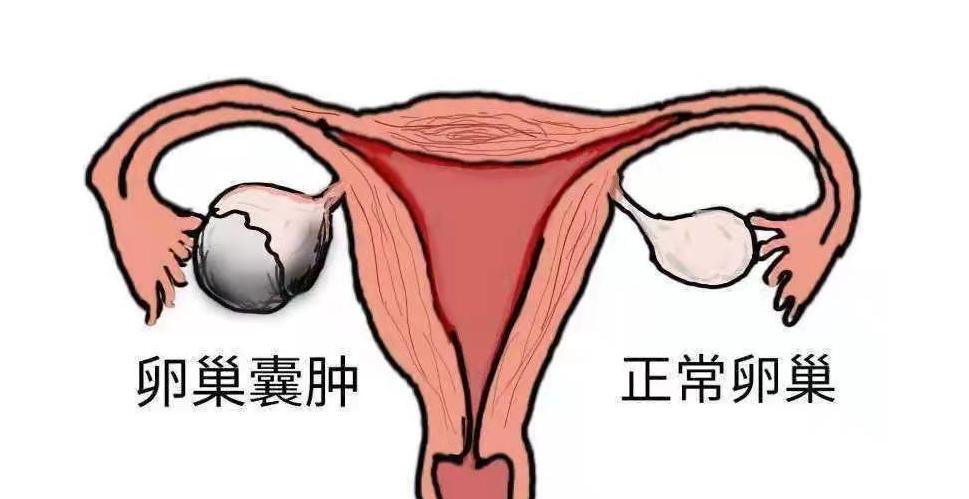 女生体检一般检查哪些必检的项目,女性体检的必检项目一般多少钱