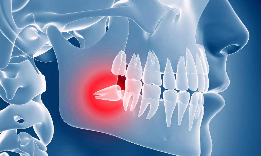 怎么根治一上火就牙疼,一上火就牙疼是牙髓炎么