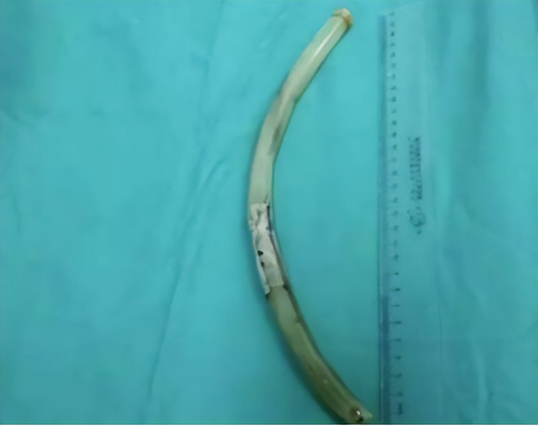 女大学生把30厘米“兔兔管”插入体内：上瘾*行为性**，害了多少人？