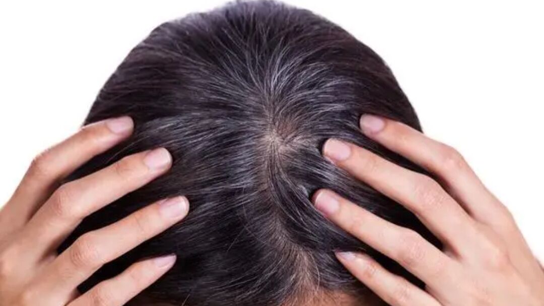 黑芝麻黑豆黑米可以让头发变黑吗,长白头发和肾虚有关系吗